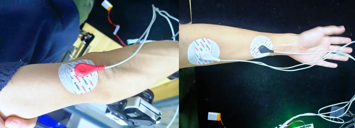 Two photos of a forearm with adhesive electrodes and snap leads attached, one near the elbow and two along the forearm